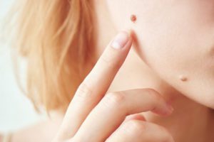 A woman with her finger on the side of her nose.
