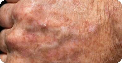 A close up of the skin on a person 's face.