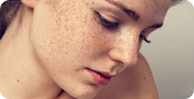 A close up of a person with freckles on their face
