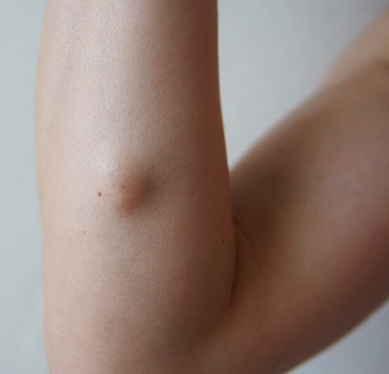 A close up of the arm and elbow of a person.