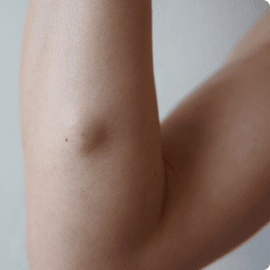 Close-up of a person's elbow.