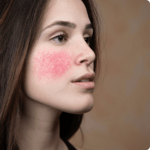 Woman with blush on her cheeks, side profile.