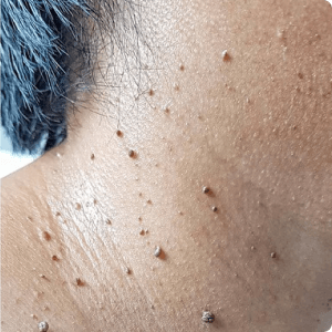 Skin with small growths or bumps.