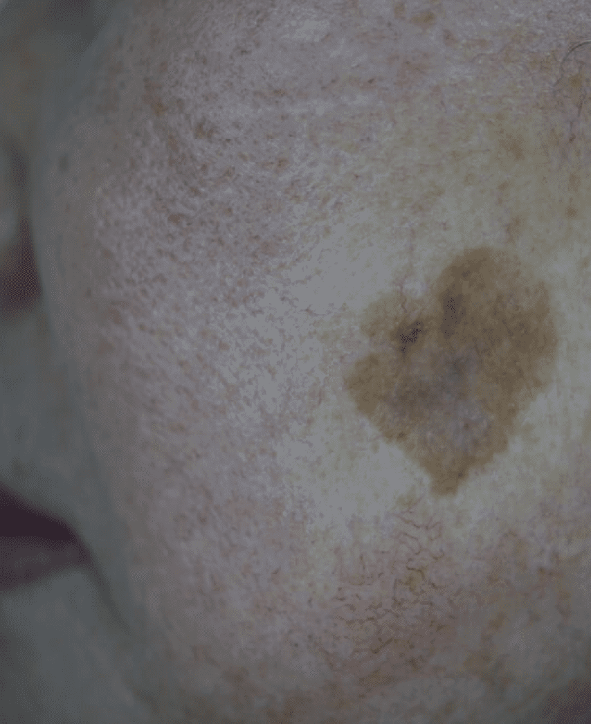 Heart-shaped mark on textured surface.