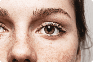 Close-up of a woman's eye with freckles.